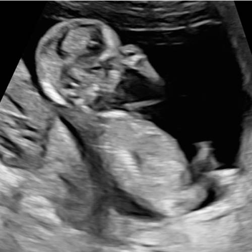 Baby Claire Fund 🎀