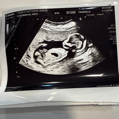 Baby-Pool 50/50 Splitting the pot with the winner!