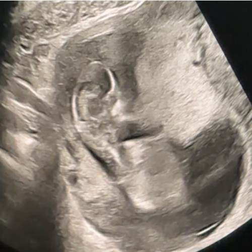Babylist Cash Fund