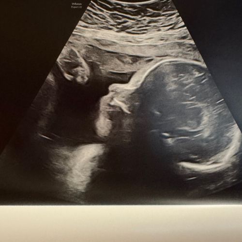 Babylist Cash Fund