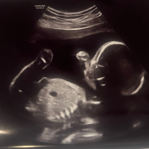 Babylist Secondhand Fund - Cash for diapers please.