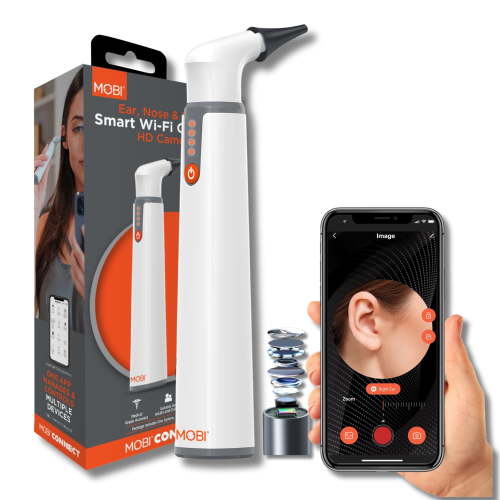 MOBI Smart Baby Otoscope Jr – 1080P HD Ear Camera with LED Lights | Helps Detect Ear Infections Early | Safe Ear, Nose & Throat Scope for Kids, Toddlers, Adults | Home Health Monitoring Tool