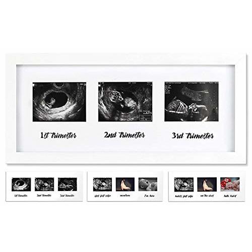 IHEIPYE Triple Sonogram Pregnancy Frame - Baby Ultrasound Picture Frame for Expecting Parents, Gender Reveal Party, Baby Nursery Decor, White
