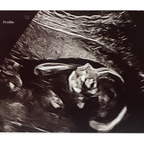Baby Fund