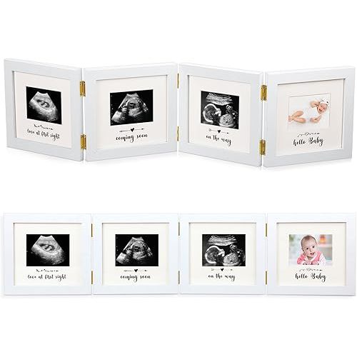 Beeveer Sonogram Picture Frame Quadruple Ultrasound Picture Frame 4 Folding Pregnancy Keepsake Photo for Pregnancy Announcements First Time to Be Dad Mom Gifts Gender Nursery Decor(White)