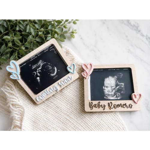 Ultrasound Magnet: Pregnancy Announcement, Baby Arrival Gift