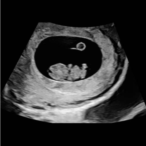 Amazon: Baby Registry