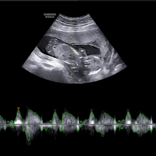 Babylist Shop Gift Card