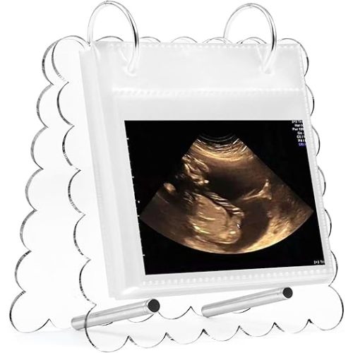 Flip Ultrasound Photo Album with Stand, Refillable Flip-Through Display for 3x4 Pictures, Acrylic Scalloped Cover, Pregnancy Gift for New Parents (Small)