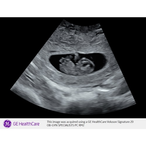 Parental Leave Fund
