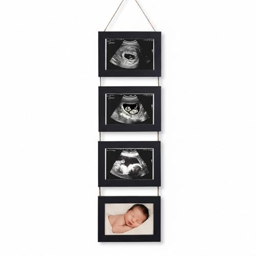 4-in-1 Sonogram Picture Frame, Display Pregnancy Keepsake Album for Pregnancy Announcements, Gender Reveal, and Newborn Photos, Perfect Gender-Neutral Nursery Decor, First Time Mom Gift, Black