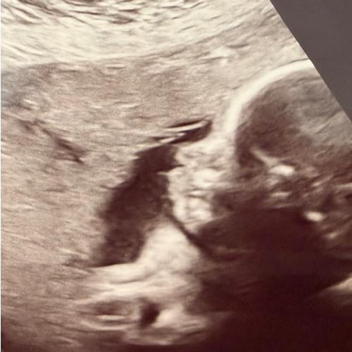 everyday baby essentials fund.