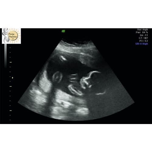 Aluneya's Baby Blessing Fund