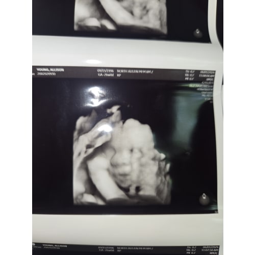 Baby Young Fund