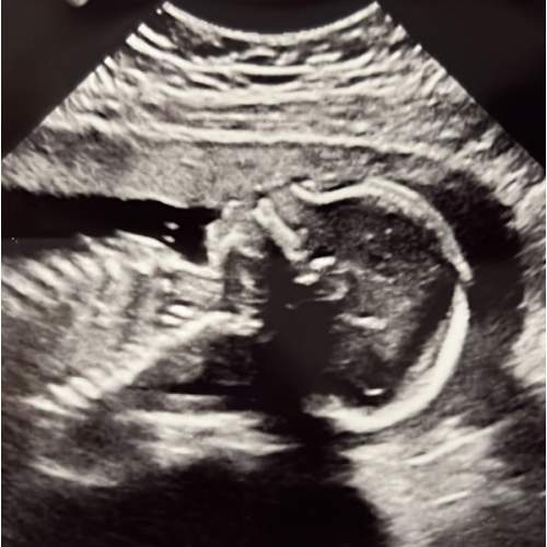 Baby Fund