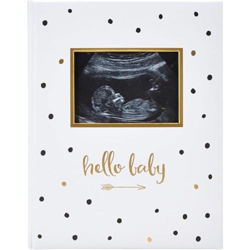 Pearhead Hello Baby First 5 Years Memory Book, Gender-Neutral Baby Keepsake for New and Expectant Parents, Pregnancy And Milestone Journal, Modern Minimalist Black and Gold Polka Dot