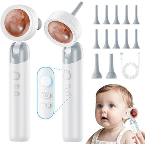 Otoscope Ear Camera with Light, 1.4” Screen 1080P HD Ear Scope, 12 Silicone Specula Tips, Photo & Video Recording, Type-C Rechargeable, Ear Cleaning Camera for Adult Kid and Pet
