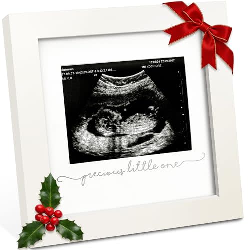 KeaBabies Baby Sonogram Picture Frame - Modern Ultrasound Picture Frames for Mom to Be, First Pregnancy Gifts for Expecting Mom & First Time Dad, Baby Gender Reveal Gifts (Alpine White)