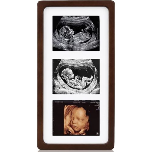 Junkin Ultrasound Picture Frames Non-tarnish Sonogram Photo Frame Love at First Sight Pregnancy Announcements Gift for First Time Moms Table Display Baby Shower Party Decoration(13.7 x 7 Inch,Vintage)