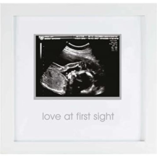 Pearhead Love at First Sight Sonogram Picture Frame, Pregnancy Keepsake Photo Frame, Gender-Neutral Baby Nursery Décor, Mother’s Day Accessory, 4x3 Photo, White