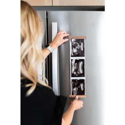 Walnut Sonogram Frame: Magnetic Ultrasound Photo Display