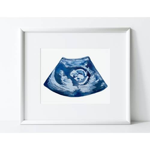 Custom Ultrasound Painting, Watercolor Ultrasound, Custom Sonogram Painting, Ultrasound Art, Sonogram Art