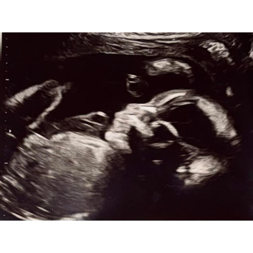 Baby B’s Gift Fund