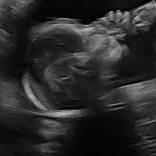 Maternity Leave Fund