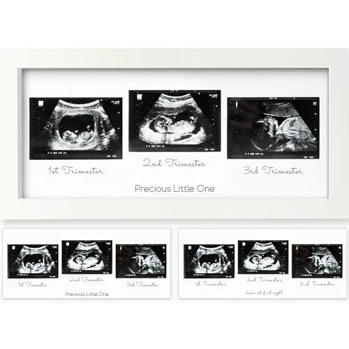 Sonogram Picture Frame - Trio Ultrasound Picture Frames For Mom To Be Gift - Baby Ultrasound frame - Pregnancy Announcements Sonogram frame - Baby Nursery Decor, Pregnant Mom Gifts(Alpine White)