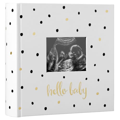 Pearhead Hello Baby Photo Album, Keepsake Book for New and Expecting Parents, Gender-Neutral Baby Accessory, Ideal Gift for Baby Shower, Holds 200 Pictures, Black and Gold Polka Dot
