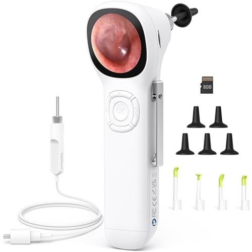 ScopeAround Digital Otoscope w/Built-in Screen, Manual-Focus Digital Otoscope with Light for Home Use, No App Needed, Easy Viewing for Everyday Ear Checks, Otoscope Camera, White