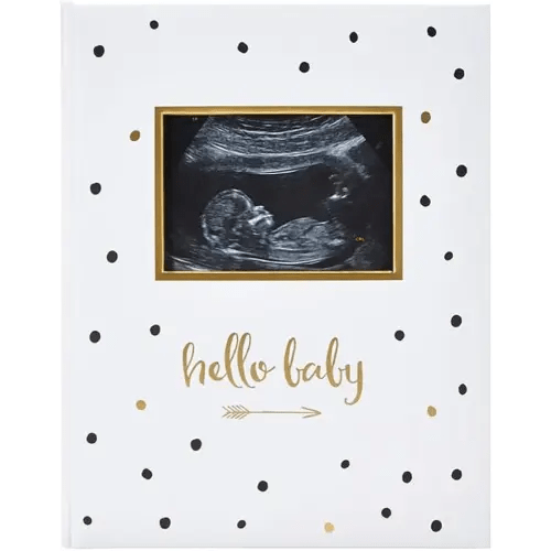 Pearhead Hello Baby First 5 Years Memory Book, Gender-Neutral Baby Keepsake for New and Expectant Parents, Pregnancy And Milestone Journal, Modern Minimalist Black and Gold Polka Dot