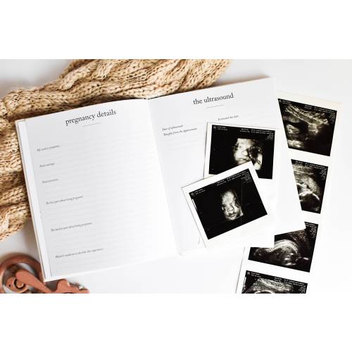 Baby Memory Book & Baby Photo Album | Baby Shower Gift for New Mom | Boy or Girl Milestone Scrapbook for Expecting Mom | First Year Journal