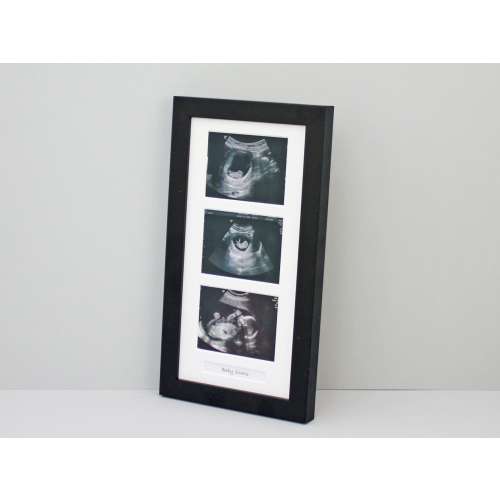 Baby Scan Photo Frame - Multi aperture Frame for Three Scan sized Photos and Text Box. Handmade. Baby Shower Gift | Pregnancy Announcement