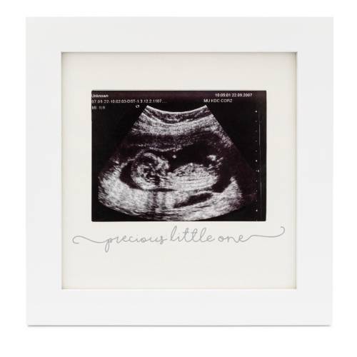 Baby Sonogram Picture Frame - White Wood Baby Ultrasound Frame, Pregnancy Gifts, Great Gift for Expecting Parents
