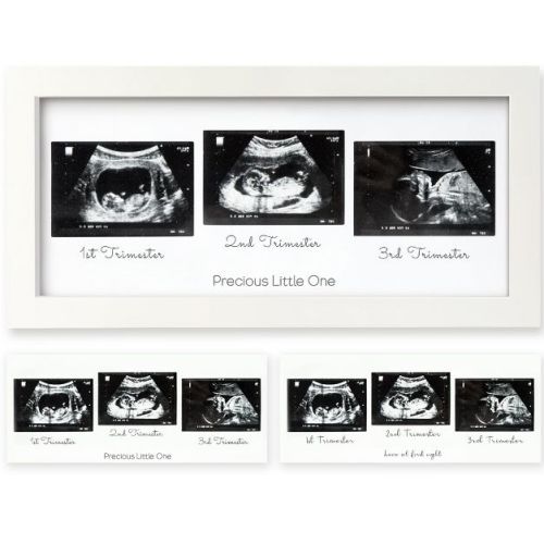 Keababies Trio Baby Sonogram Picture Frame, Baby Ultrasound Picture Frames For Baby Nursery, Mom To Be Gifts (alpine White)