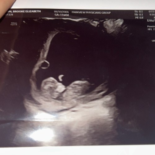 Baby’s Fund