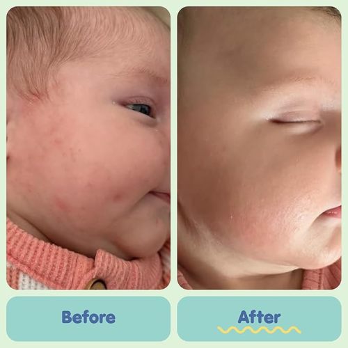 TUBBY TODD All Over Ointment - Baby Eczema Cream - Everyday Multi-Purpose Baby Skin Relief Cream - Sensitive Skin, Dry Skin & Irritation - Steroid & Gluten Free - Lavender Rosemary, 2 Pack 3.5oz & 8oz