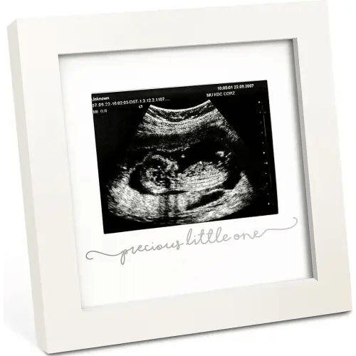 Baby Sonogram Picture Frame - Modern Ultrasound Frame for Mom to Be - Pregnancy Announcement Sonogram Photo Frames - Gender Reveal for Expecting Parents - First Time Dad Gifts (Alpine White)