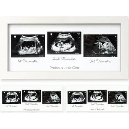 Trio Baby Sonogram Frame