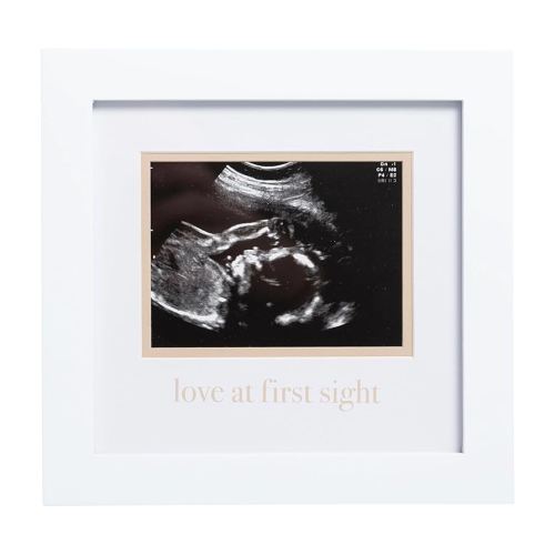 Pearhead Love At First Sight Sonogram Frame, Ultrasound Picture Frame, Pregnancy Announcement Photo Frame, Baby Keepsake Gift For Expecting Parents