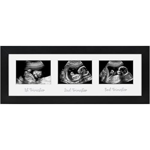 Americanflat Sonogram Picture Frame with Shatter-Resistant Glass - 15x5 Frame Fits Three 3x4 Sonograms with Interchangeable Mats - Signature Collection - Photo Frames for Tabletop and Wall - Black