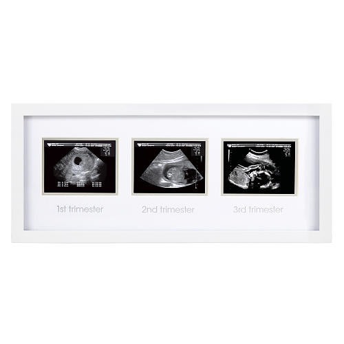 Pearhead White Trimester Sonogram Picture Frame
