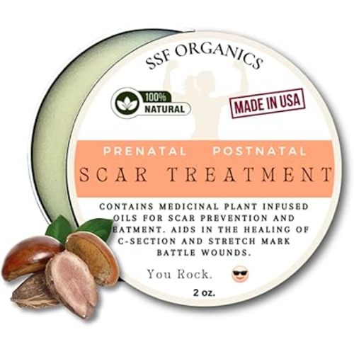 SSF Organics Scar Treatment for Stretch Marks, C-Section Recovery Must Have- Deeply Moisturize with Calendula, Castor, Shea - Advanced Scar Treatment for Mama Related Wounds
