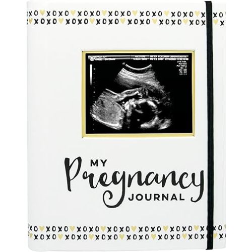 Pearhead My Pregnancy Journal - 74-Page Memory Book and Photo Album, Gender Neutral Planner for Expecting Moms, Includes Milestone Sections and Ultrasound Photo Insert