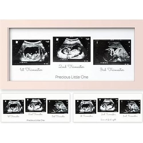 Sonogram Picture Frame - Trio Ultrasound Picture Frames For Mom To Be Gift - Baby Ultrasound frame - Pregnancy Announcements Sonogram frame - Baby Nursery Decor, Pregnant Mom Gifts (Petal Pink)