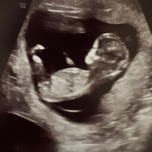 Cash Fund for Baby Sy