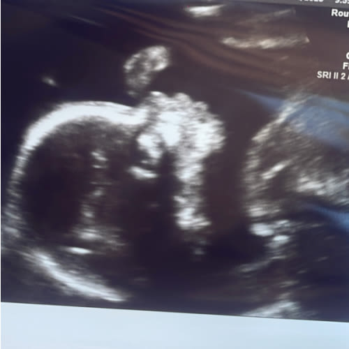 Brooklin Pettway and Kelvin Jones’ Baby Registry at Babylist