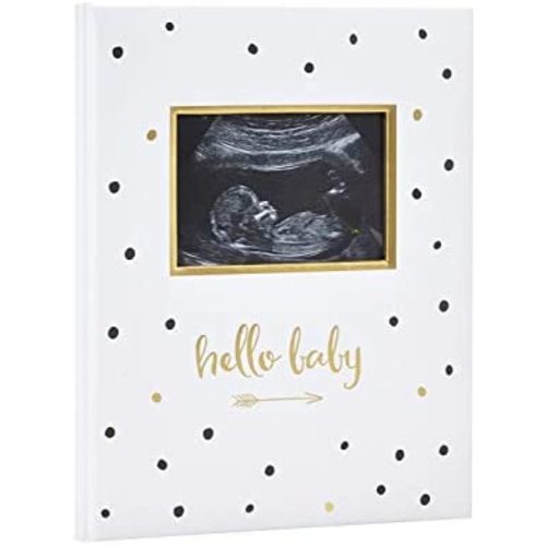 Pearhead First 5 Years Baby Memory Book with Sonogram Photo Insert, Black and Gold Polka Dot