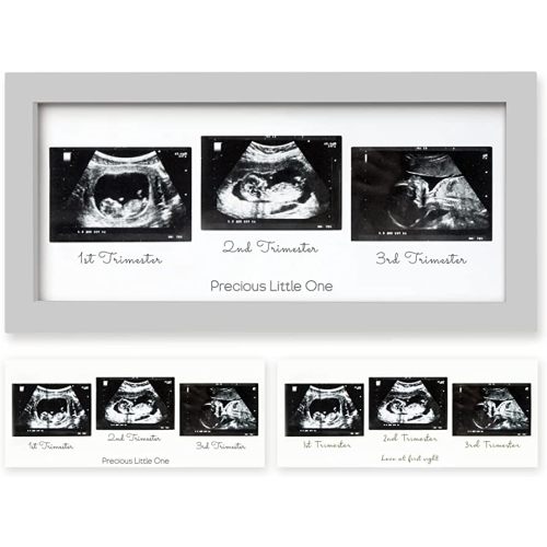 Sonogram Picture Frame - Trio Ultrasound Picture Frames For Mom To Be Gift - Baby Ultrasound frame - Pregnancy Announcements Sonogram frame - Baby Nursery Decor, Pregnant Mom Gifts (Cloud Gray)